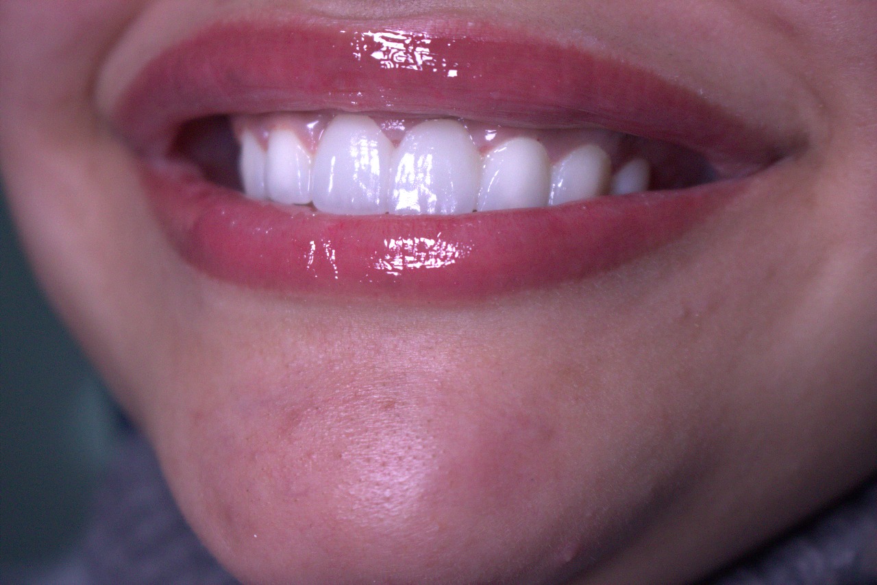 ابتسامة جميلة 1