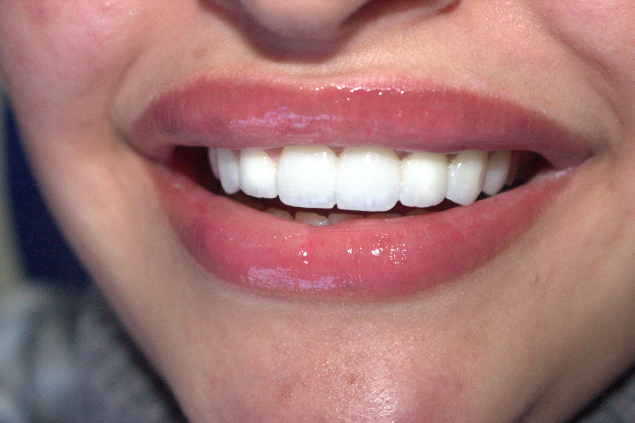 نتيجة مذهلة 1