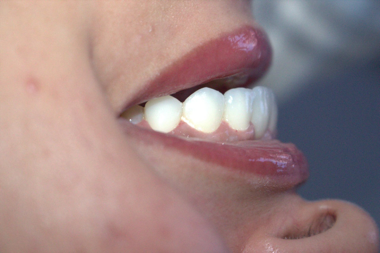 نتيجة مذهلة 2